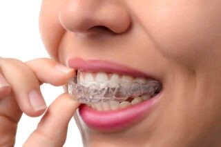 Affordable Invisalign quotes North Las Vegas