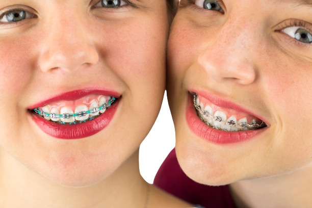 Best Affordable North Las Vegas Orthodontists